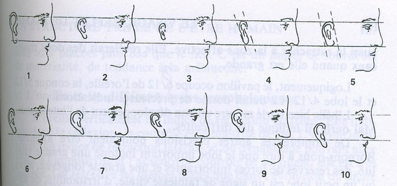 La personnalité de l’Homme, en fonction de la forme de son oreille.