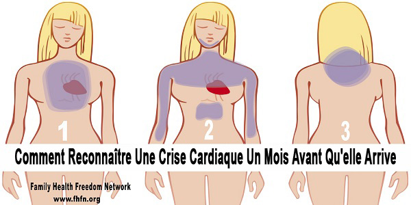 – Détecter les Signes Précurseurs : 6 Symptômes de Crise Cardiaque à Ne Pas Ignorer