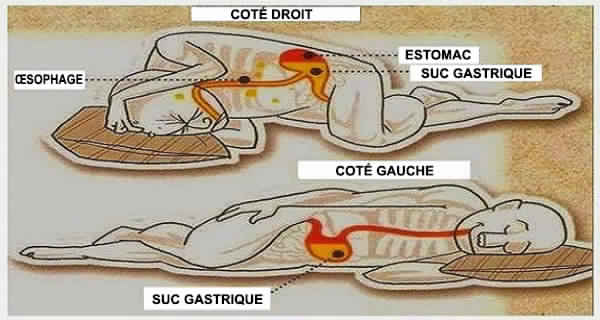 Voici pourquoi vous devriez dormir sur le côté gauche