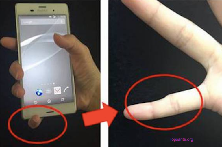 Tenir votre Smartphone de cette façon pourrait conduire à un doigt déformé!