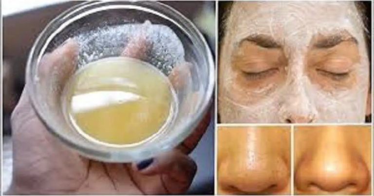 La crème d’huile de coco et de bicarbonate de soude pour rajeunir la peau