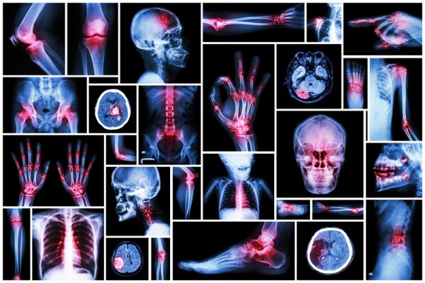 20 Sources de douleur qui sont directement liées à des états émotionnels spécifiques