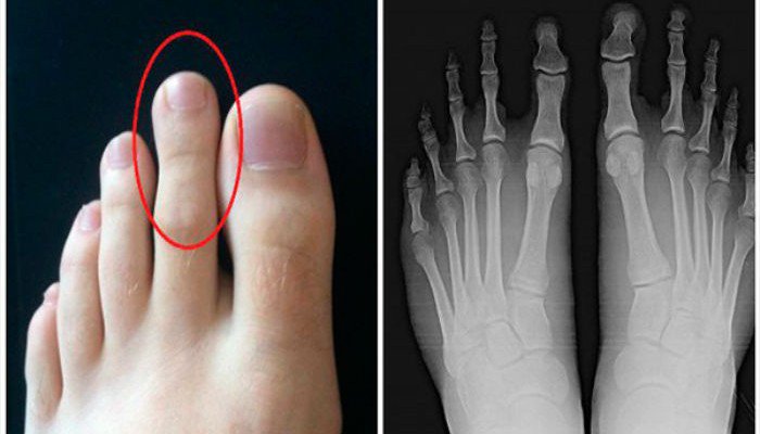 Quel est l’orteil le plus long de votre pied ? Une caractéristique qui en dit long sur votre personnalité