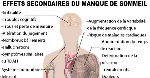 – Ne pas dormir tue : dépression, maladies cardiaques, diabète…Voici une liste de maladies causées par le manque de sommeil !
