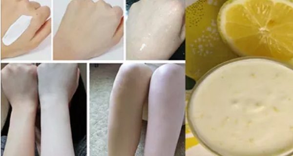 Taches foncées sur les mains et les pieds : que faire ?