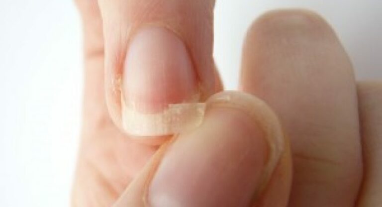 3 recettes pour lutter contre le dédoublement des ongles