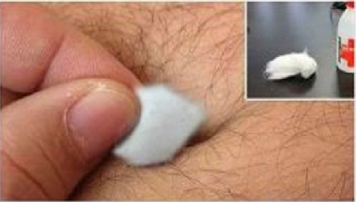 Mettre ceci dans votre nombril pour vous débarrasser de la toux, du rhume, et des ..