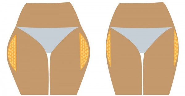 3 étapes simples qui vous aideront à se débarrasser de la graisse des cuisses rapidement!