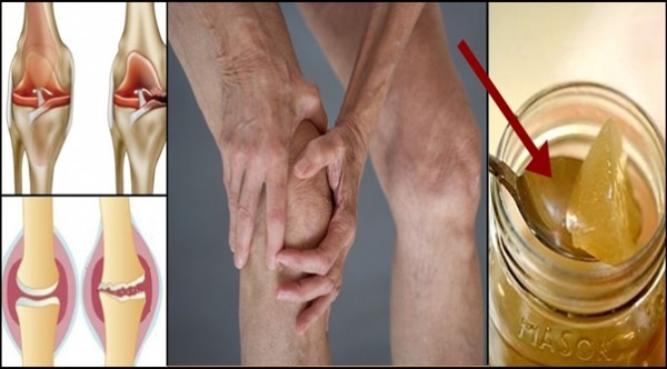 La racine de la douleur de genou est un dommage du cartilage.voici comment le régénérer