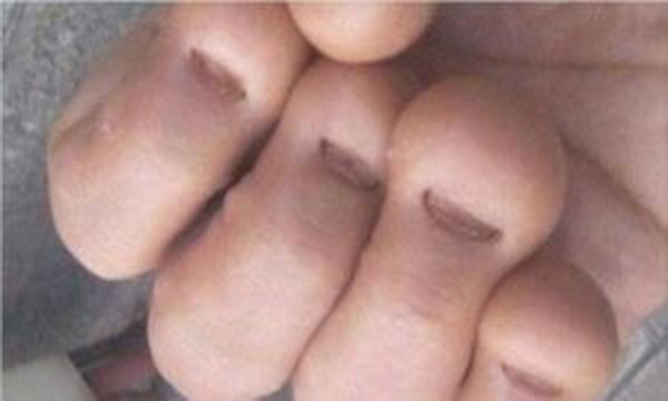 Se Ronger les Ongles Peut Vous Coûter la Vie : L’Histoire Tragique de John Gardener
