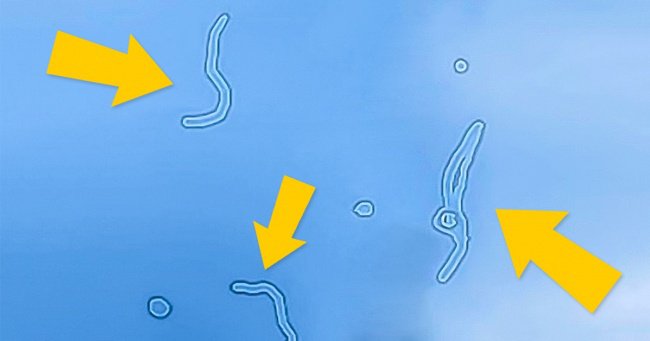 Pourquoi il vous arrive de voir des choses flottantes dans vos yeux !