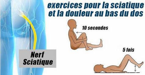 6 des meilleurs exercices pour soulager la sciatique et le bas du dos !