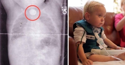 Un objet dans votre maison avec lequel tous les enfants jouent peut être fatal !