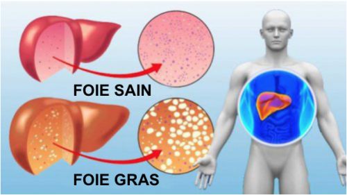 Comment préparer un jus à l’aloe vera pour purifier le foie et brûler des graisses