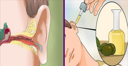 Voici comment mettre fin aux maux d’oreilles et aux otites naturellement!