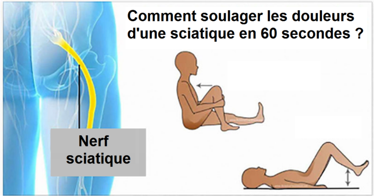 Comment soulager les douleurs d’une sciatique en 60 secondes ?