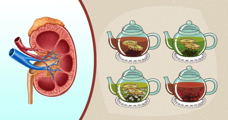 Nettoyez naturellement vos reins avec ces 4 boissons et filtrez le flux sanguin également !