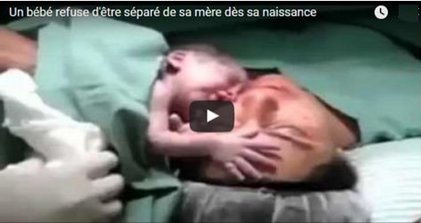 # Un bébé refuse d’être séparé de sa mère dès sa naissance, Vraiment C’est Très Mimi Regardez!!!