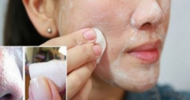 Astuce simple et naturelle pour réduire les points noirs efficacement