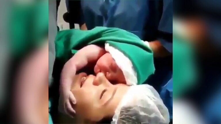 # Ce bébé refuse d’être séparé de sa mère à la naissance ?