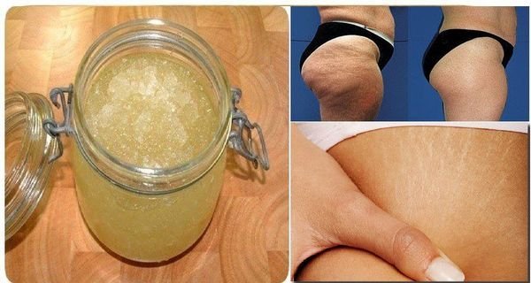 Crème Anti-Cellulite faite maison. Résultats visibles en 7 jours!