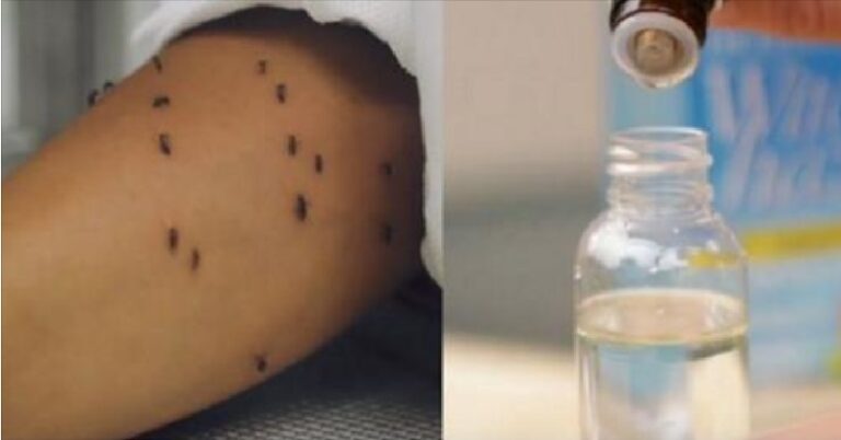 Comment faire un chasse-moustiques ultrapuissant avec de la vanille ?