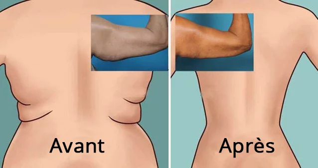 L’exercice brûle-graisse pour muscler le dos et la région des aisselles