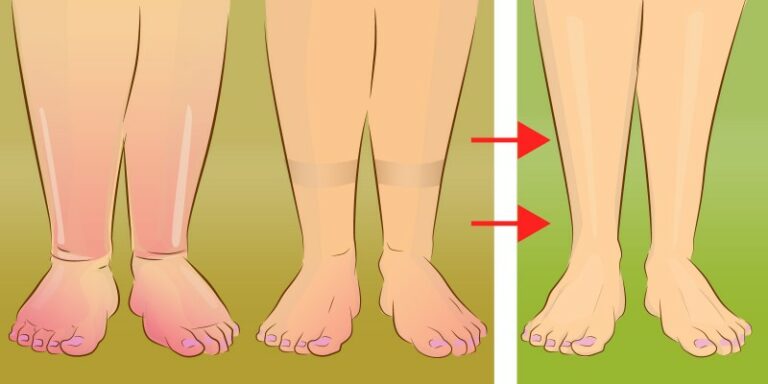Rétention d’eau : 5 gestes simples qui peuvent aider à réduire les gonflements