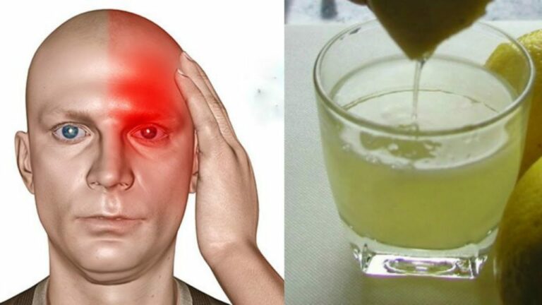 Remède Naturel contre les Maux de Tête et les Migraines : Une Solution Simple à Base d’Ingrédients Naturels