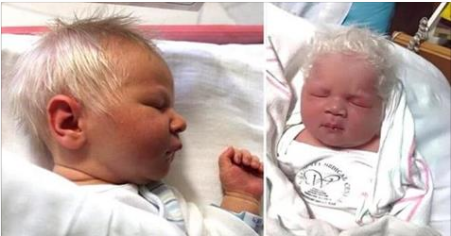 Un couple donne naissance à un bébé aux cheveux argentés. Les médecins sont tous d’accord au sujet de la cause!