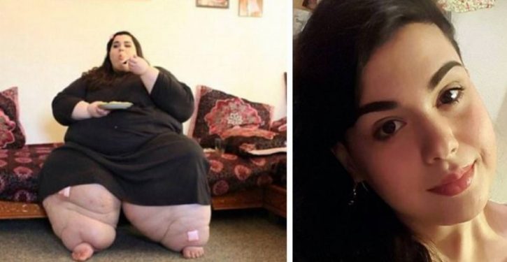 Elle pesait 300 kilos, maintenant, regardez sa transformation après avoir perdu 121 kilos !