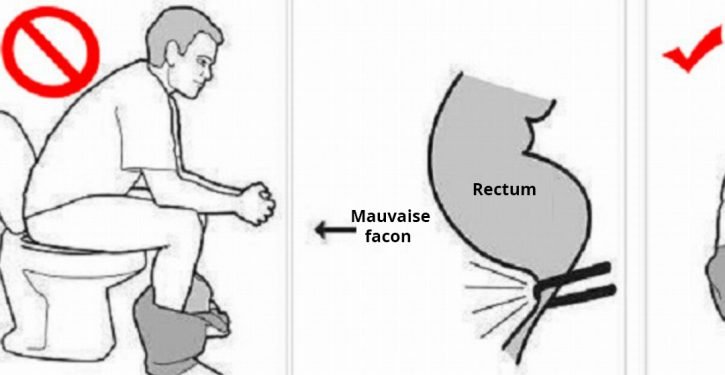 Vous faites caca de la mauvaise manière et vous n’êtes même pas au courant