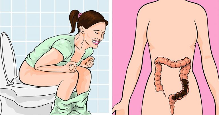 Vous êtes constipé ? Voici ce que vous devez faire pour faire travailler vos intestins