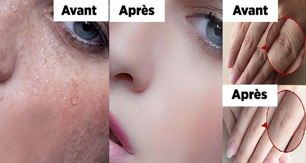 Masque de beauté pour estomper les taches brunes de nuit pour se réveiller aussi jolie qu’une princesse