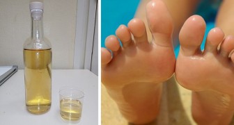 Le vinaigre est un allié précieux pour le bien-être de nos pieds : voici toutes les façons de l’utiliser