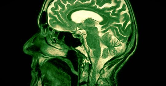 Oublier est un signe d’intelligence, c’est la science qui le dit !