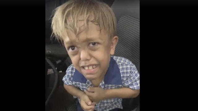 Victime de harcèlement scolaire, un enfant atteint de nanisme annonce à sa mère qu’il veut se suicider