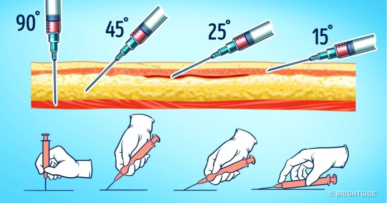 Comment faire une injection si tu n’en as jamais fait auparavant