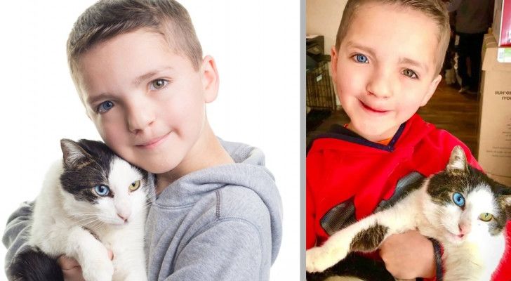 Un enfant adopte un chat ayant la même condition génétique que la sienne : ils sont maintenant meilleurs amis