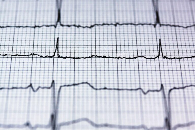 8 signaux corporels qui peuvent indiquer un trouble cardiovasculaire