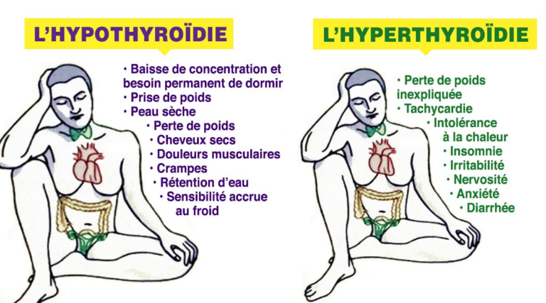 Comment distinguer l’hypothyroïdie du l’hyperthyroïdie et comment les prévenir à temps?