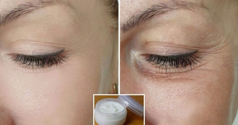 5 astuces pour rajeunir le contour des yeux et lifter les paupières tombantes