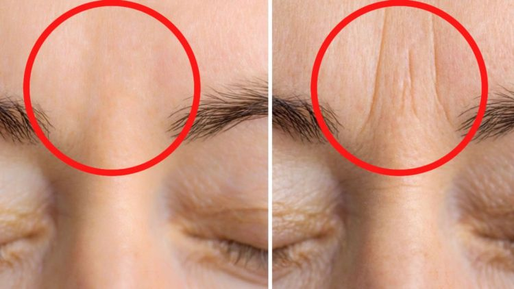 Comment réduire l’apparence des rides entre les sourcils avec cette recette naturelle