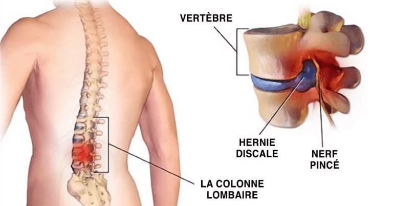 Le secret pour vous débarrasser des maux de dos est dans vos pieds. Voici 5 exercices qui vont tout arranger